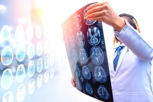 Doctor reviews brain scans of a patient represented by South Florida brain injury lawyer